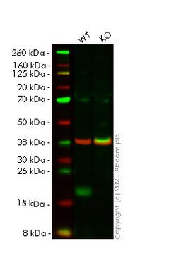 WB - EIF4EBP1 knockout HeLa