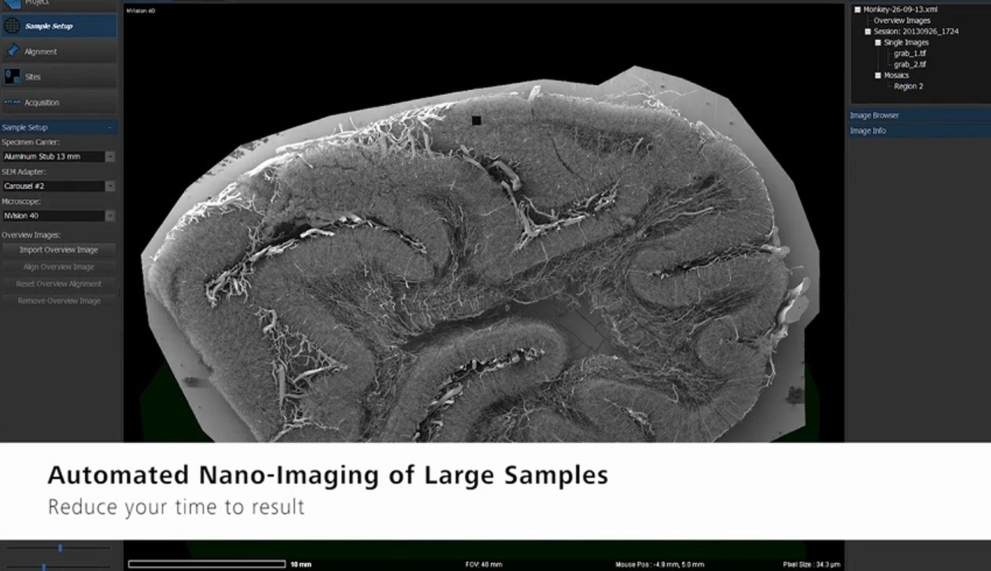 ZEISS Atlas 5 Array Tomography and Correlative Microscopy ZEISS Atlas 5 Array Tomography and Correlative Microscopy