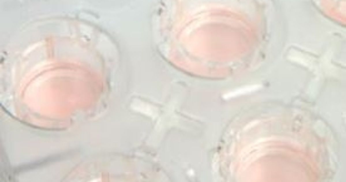 Thermo Scientific™ Nunc™ Cell Culture Inserts SelectScience