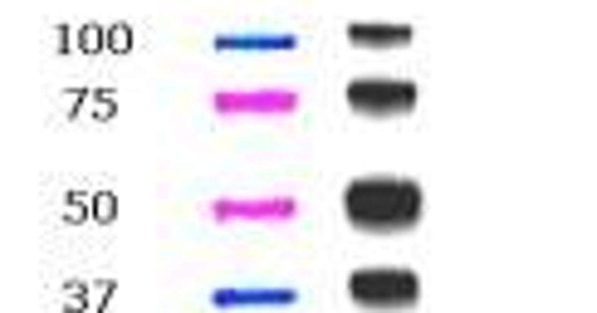 Bio-Rad Announces Availability of a Western Blotting Standard and ...