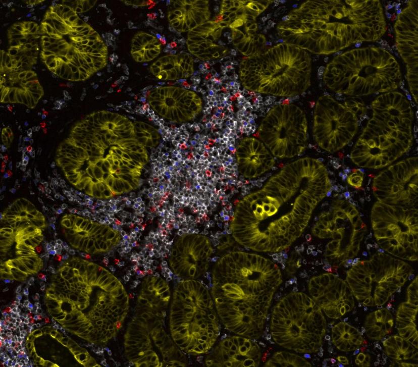 Image showing 15-Plex Orion imaging of tonsil lymphoid hyperplasia