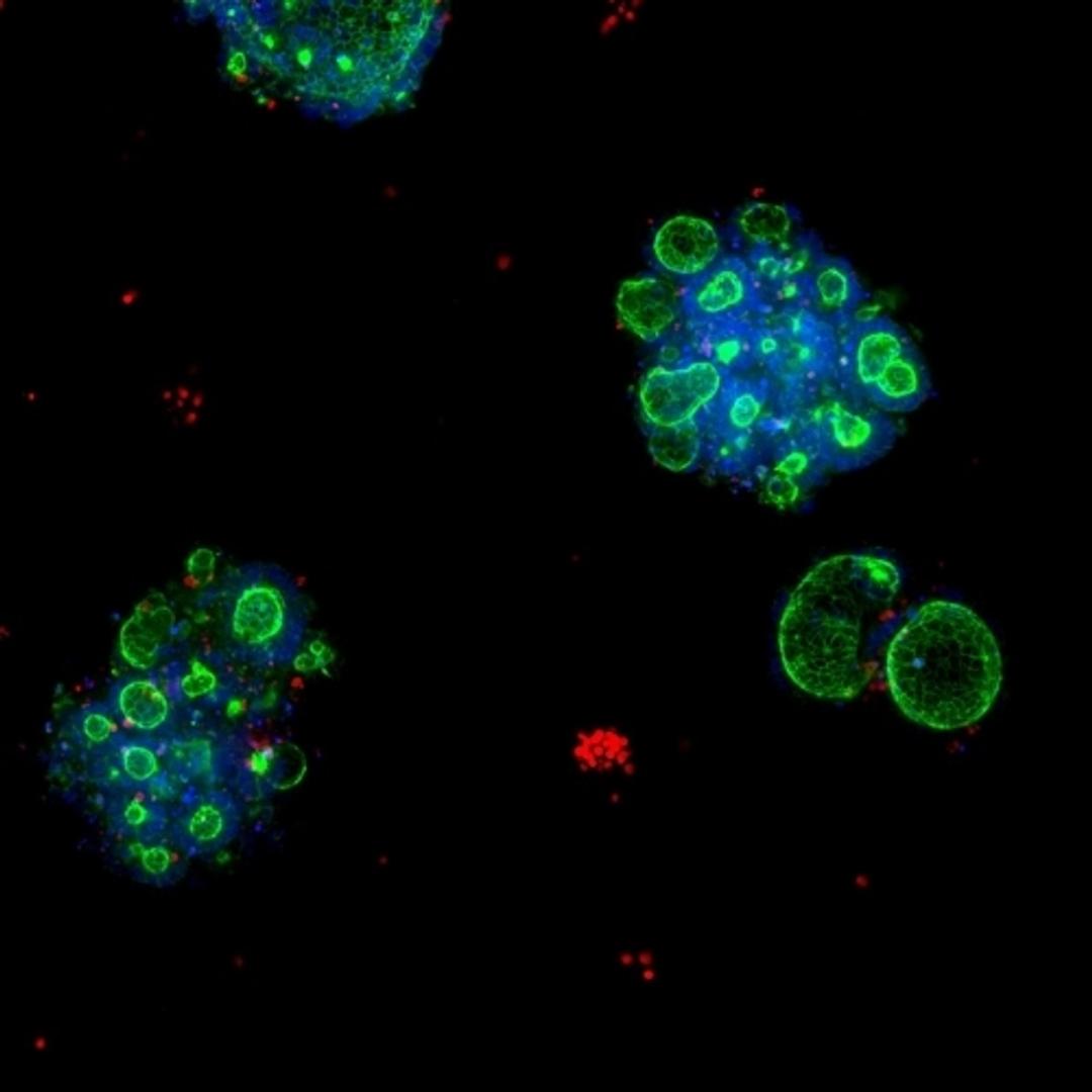 Resized-organoids