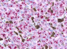 Immunohistochemistry Reagents