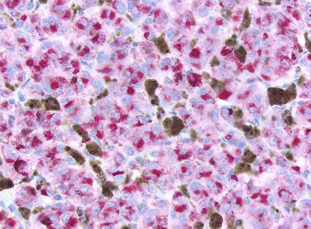 Immunohistochemistry Reagents