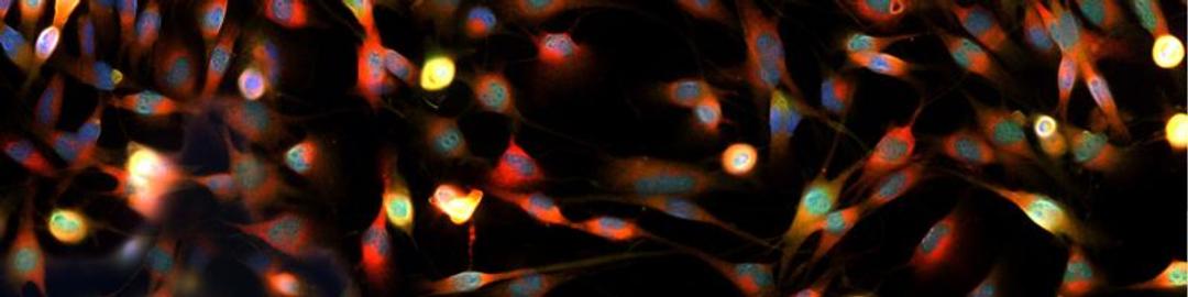 Cell counting and imaging for cell and gene therapy success