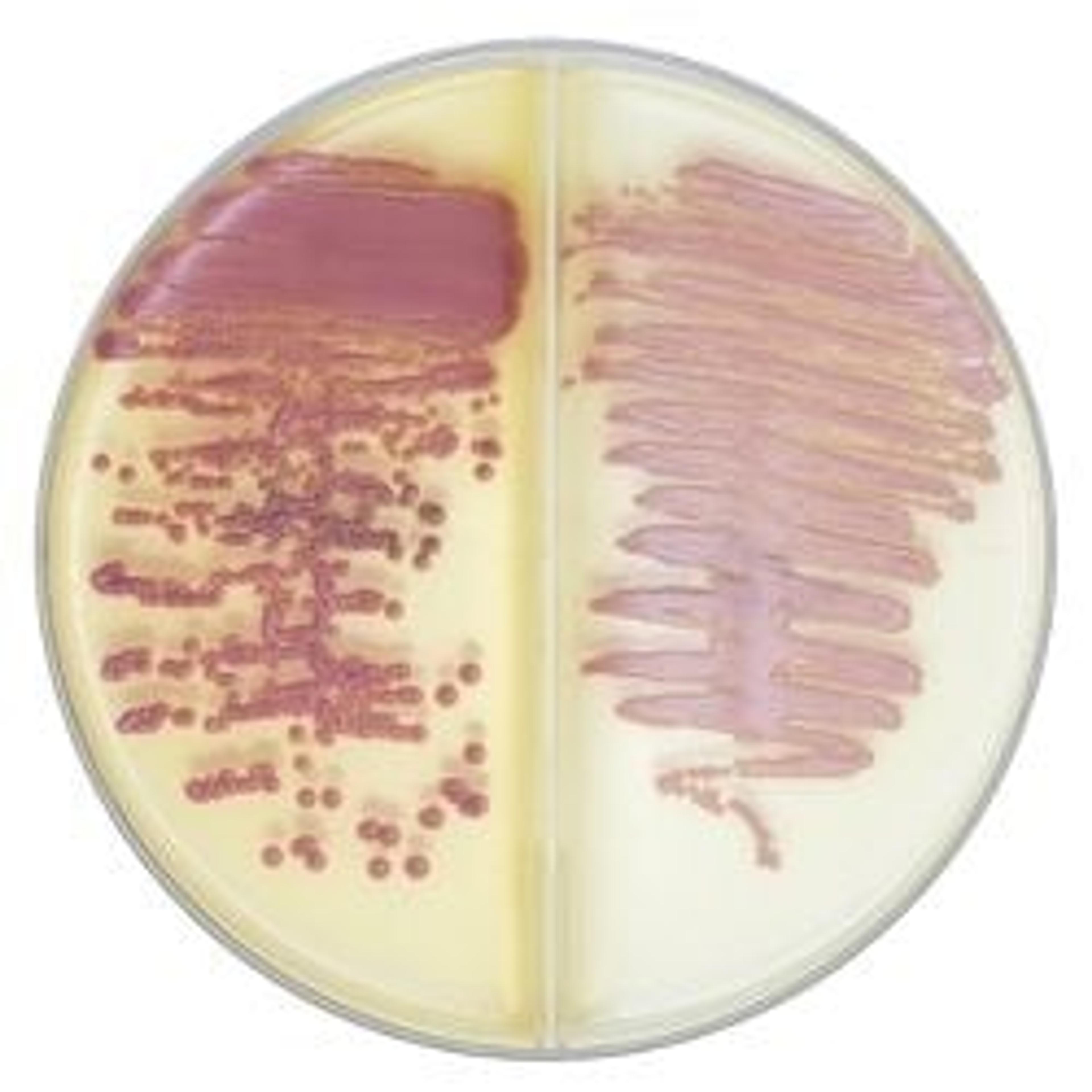 Bi-plate BD BBL™ CHROMagar™ MRSA II/CHROMagar™ Staph aureus