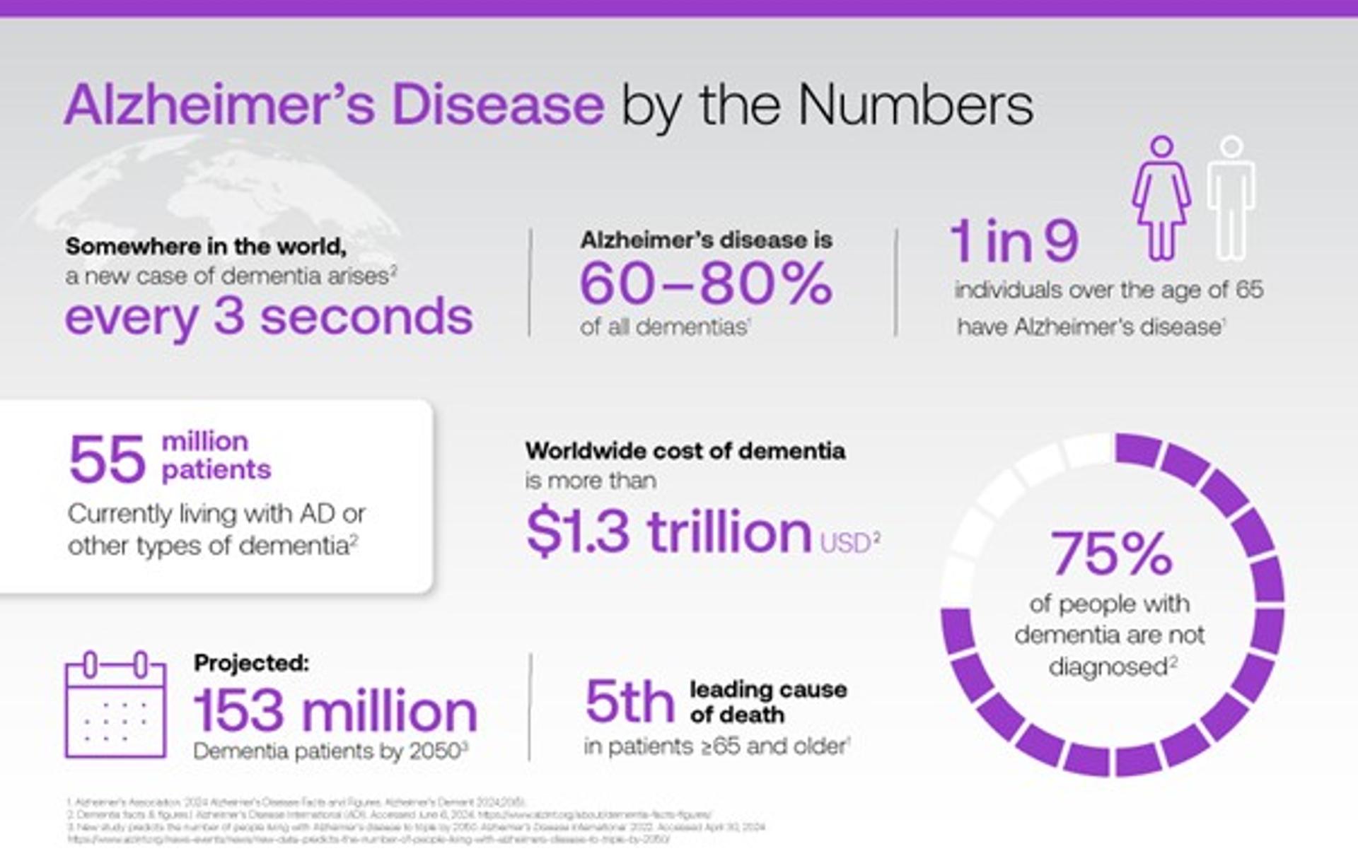 Alzheimer's disease by the numbers Beckman Coulter infographic