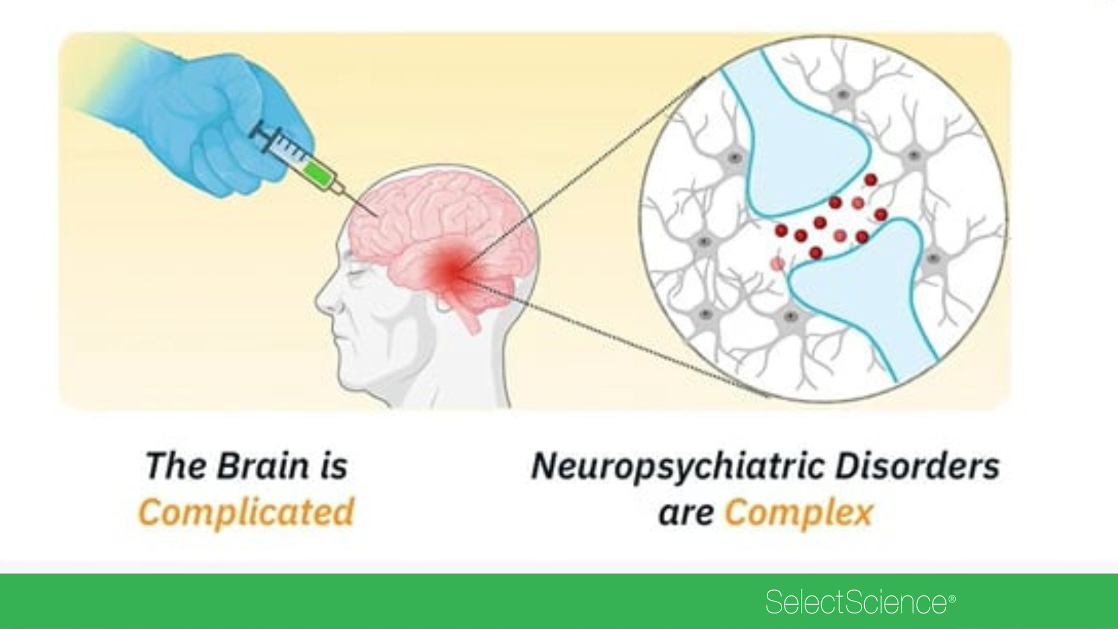 How human cerebral organoids are transforming epilepsy modeling and drug discovery