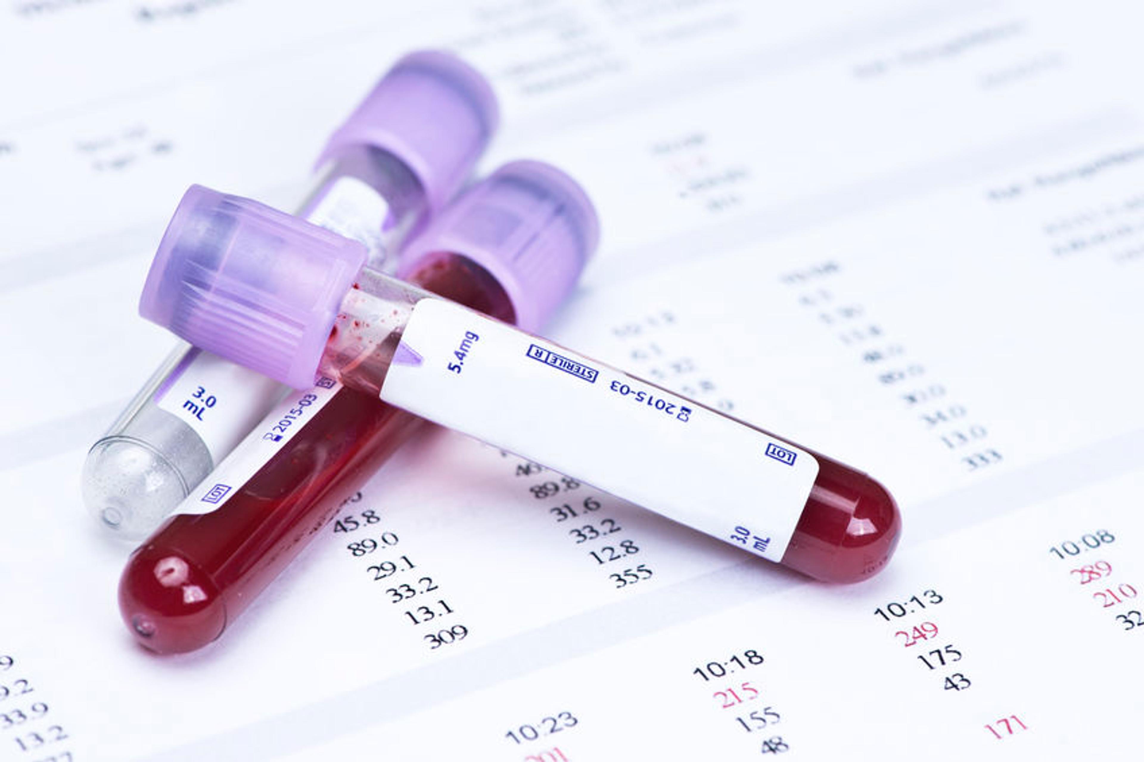 AI in hematology labs is transforming diagnostics and efficiency in 2025