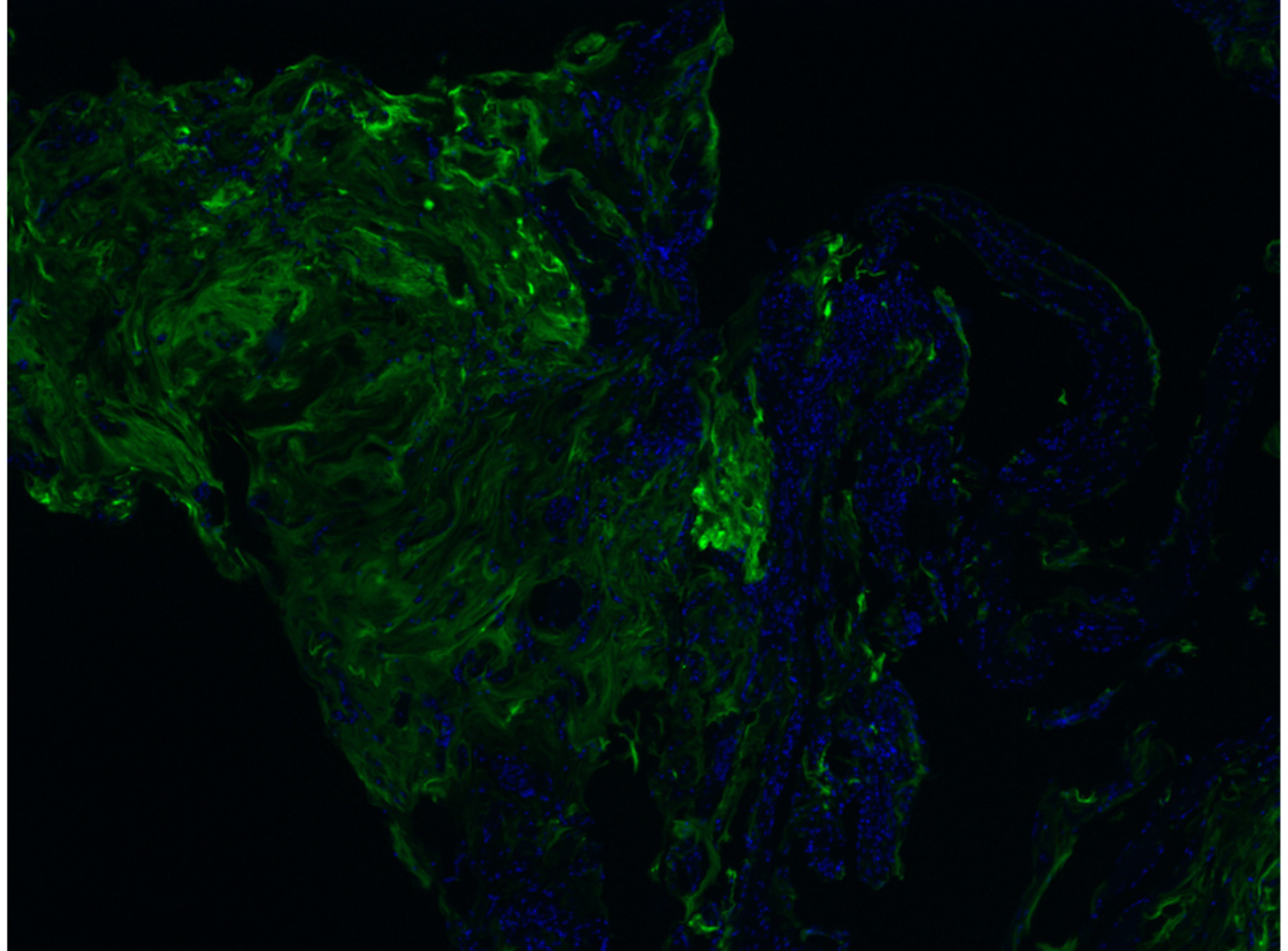 Purified antibodies enhance the precision of spatial biology studies by providing reliable data on cellular interactions within tissues. ©lightwise @123rf.com  