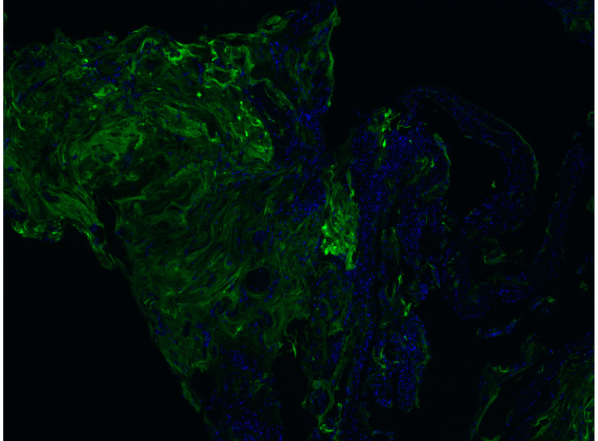 Purified antibodies enhance the precision of spatial biology studies by providing reliable data on cellular interactions within tissues. ©lightwise @123rf.com