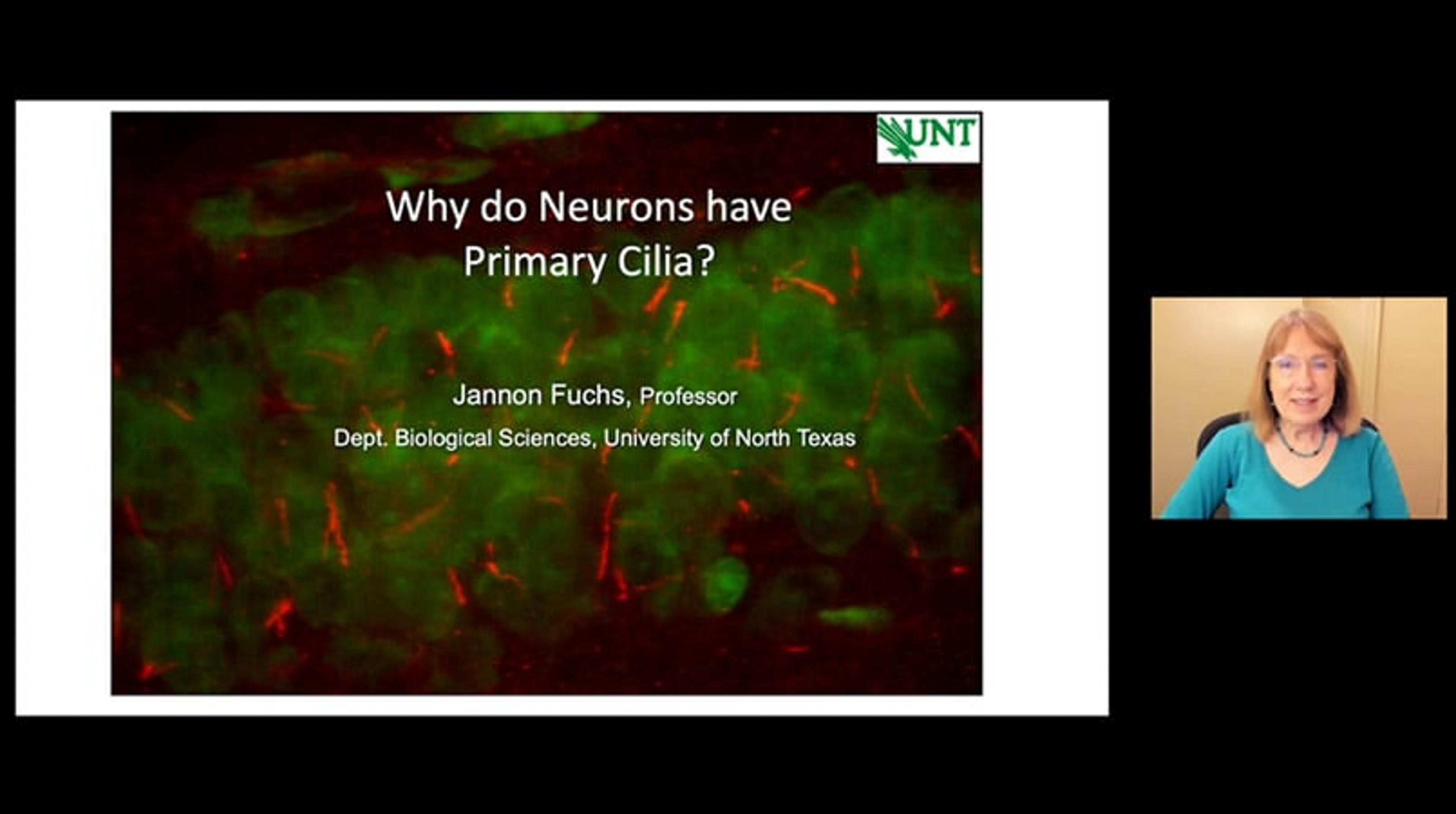 Why do neurons have primary cilia? Why do neurons have primary cilia?