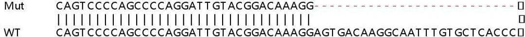 Sanger Seq - SIPA1 knockout HeLa