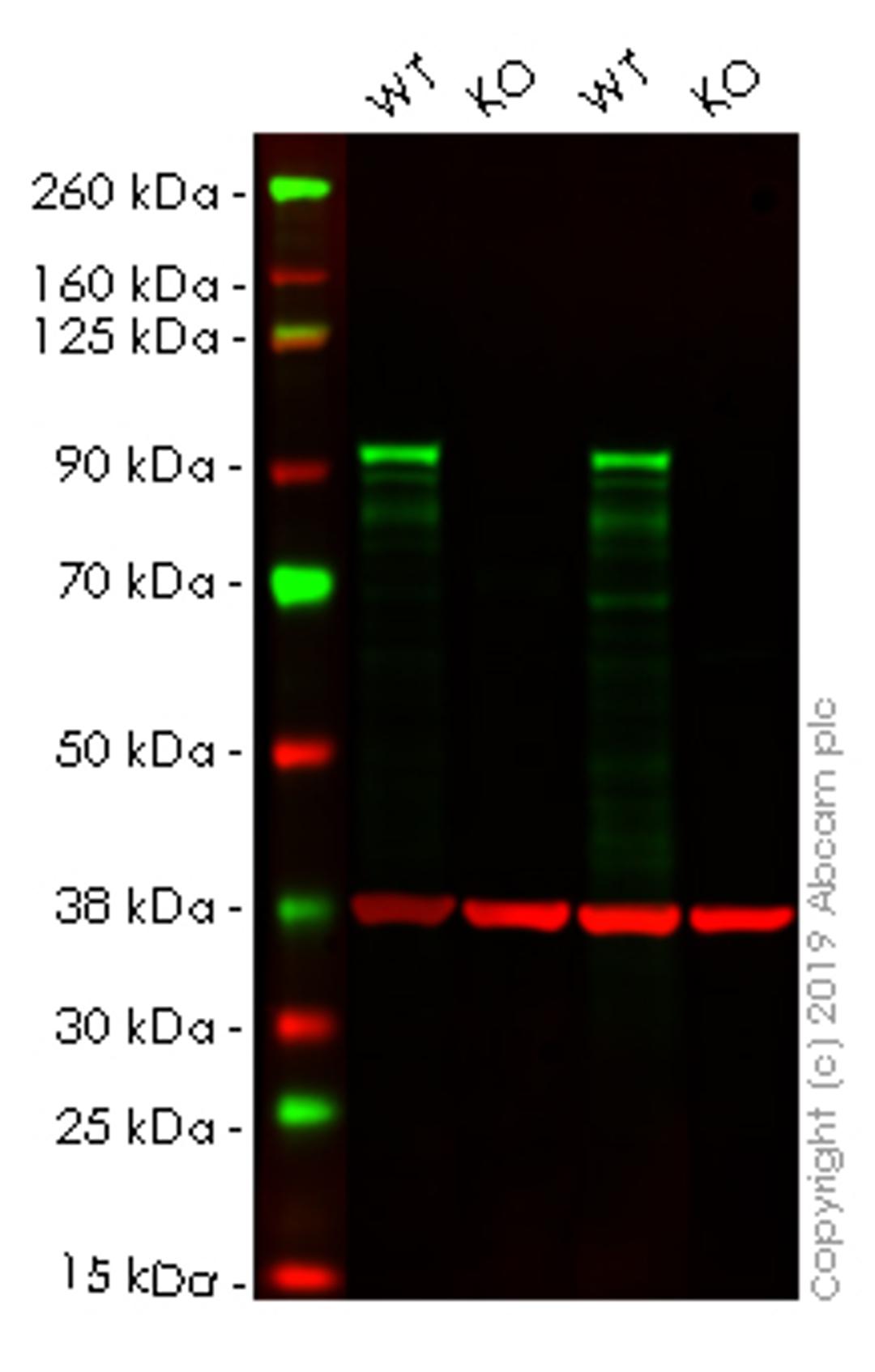 WB - NR3C1 knockout HeLa