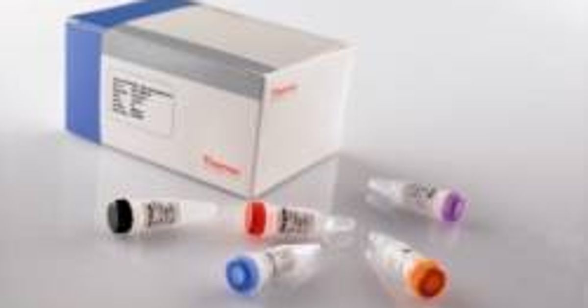 Thermo Scientific Verso cDNA Synthesis Kits