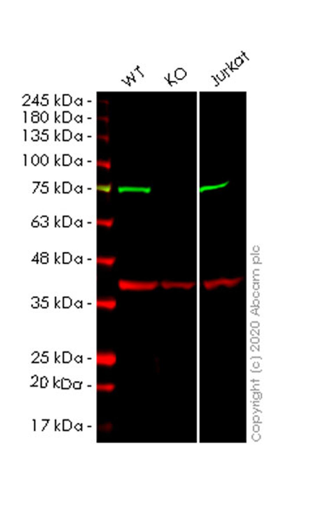 WB - COIL knockout HeLa