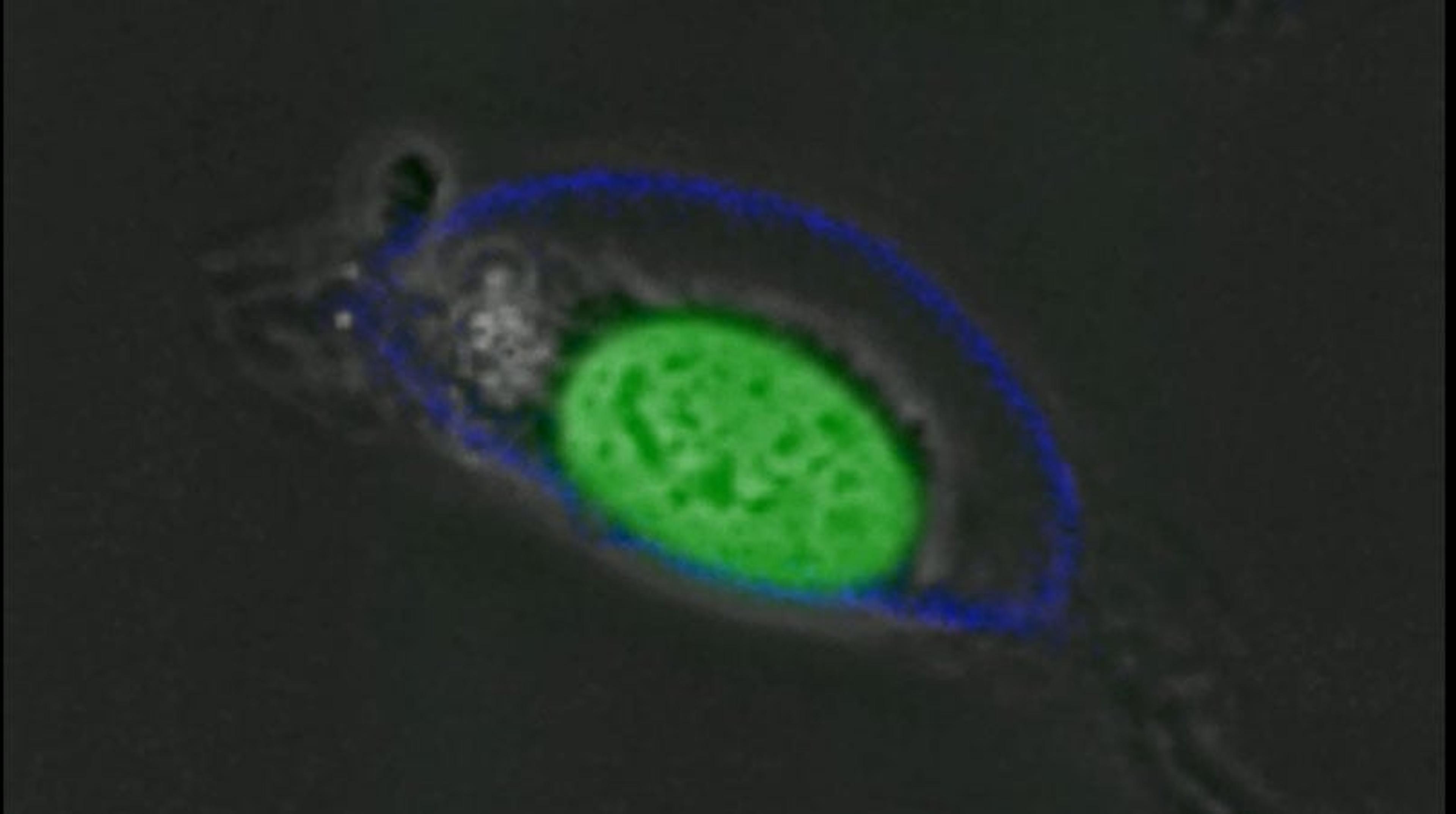 Apoptosis Detection in Real Time Apoptosis Detection in Real Time
