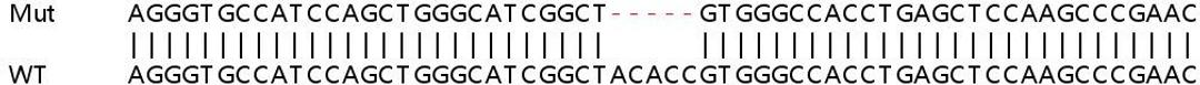 Sanger Seq - PIP5K1C knockout HeLa