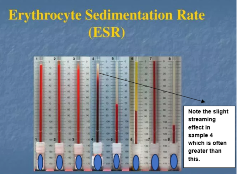 ESR tests