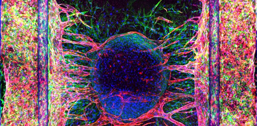 A vascularized liver spheroid in the OrganoPlate® (Blue: DNA, Green: Actin, Red: RFP-HUVEC, Magenta: VE-Cadherin)