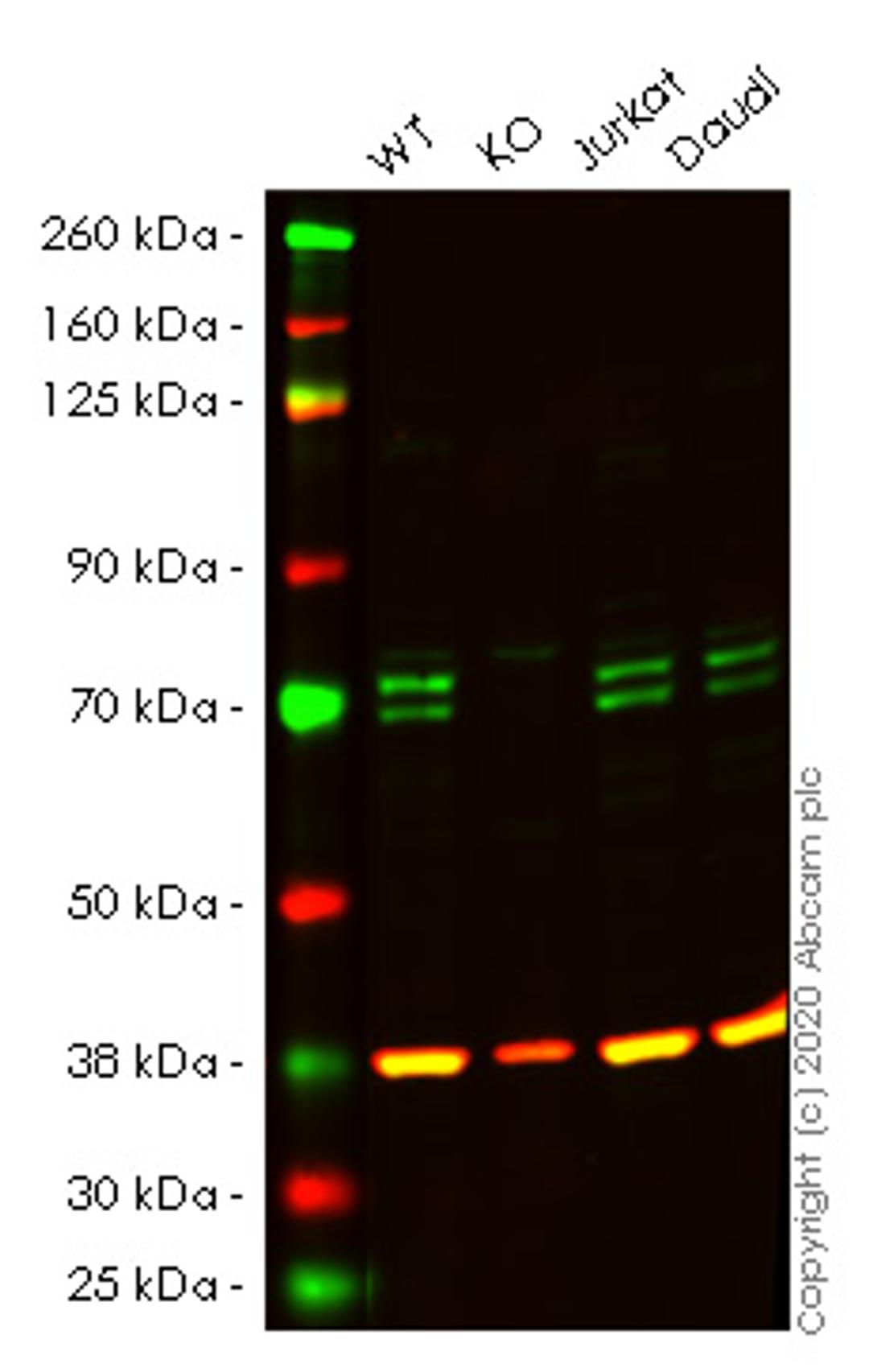 WB - ATG16L1 knockout HeLa