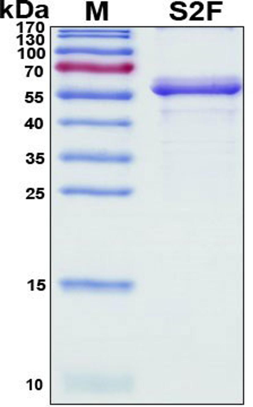 SDS-PAGE