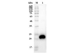 Anti-Human VEGF Recombinant Antibody (Bevacizumab)