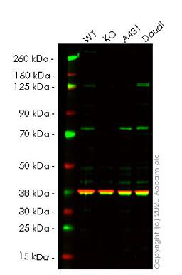 WB - TRIM29 knockout HeLa