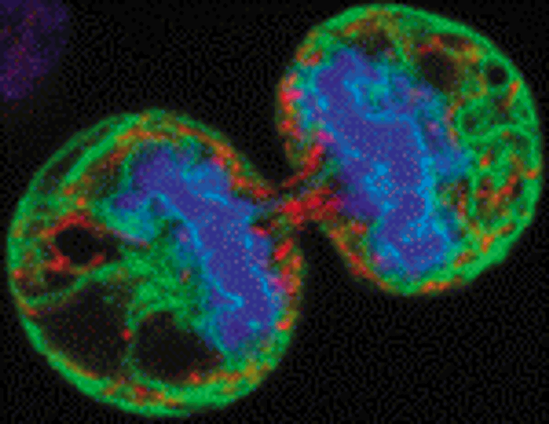 melanoma cells in cell division