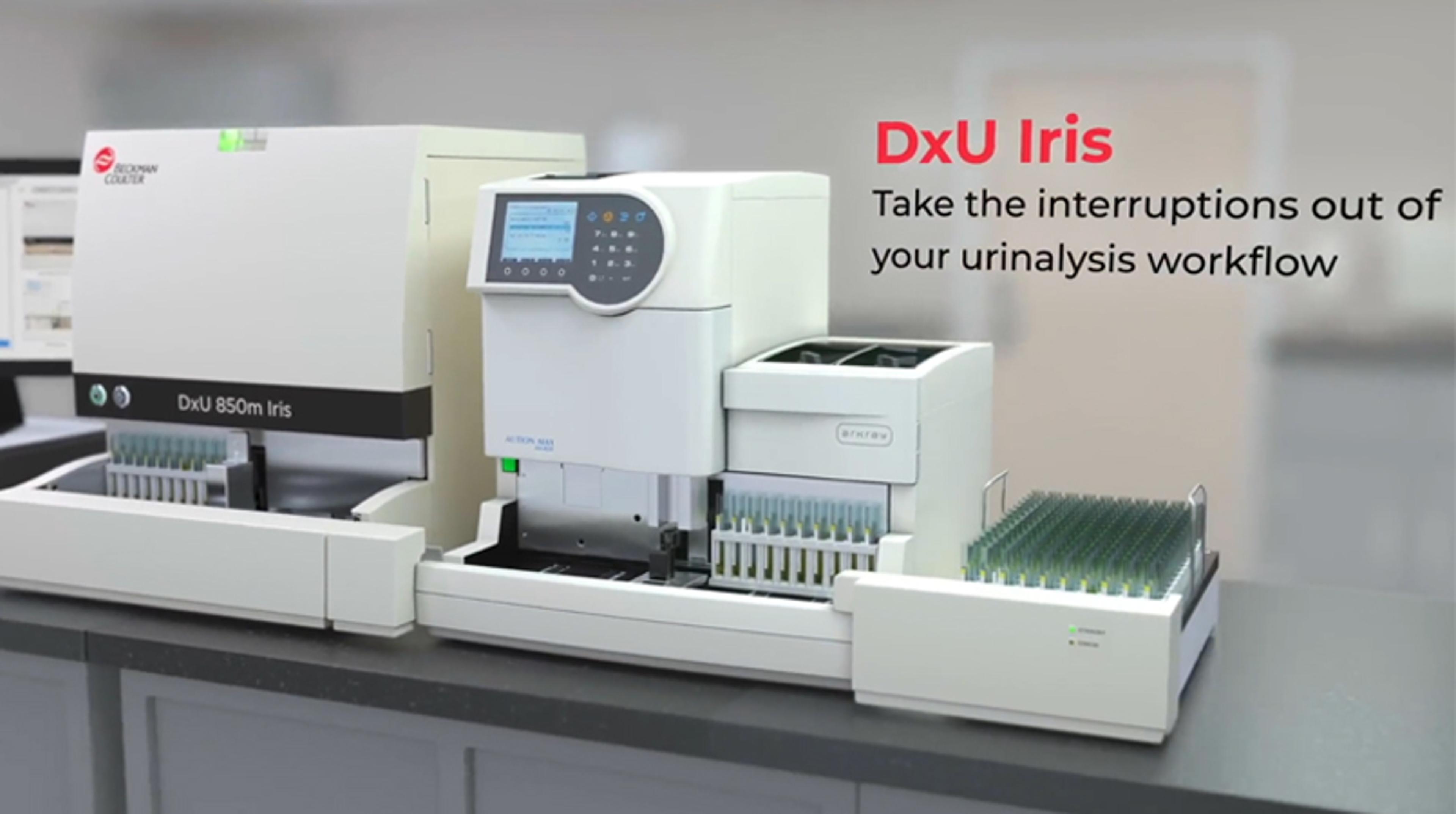 DxU Iris: Take the interruptions out of your urinalysis workflow DxU Iris: Take the interruptions out of your urinalysis workflow