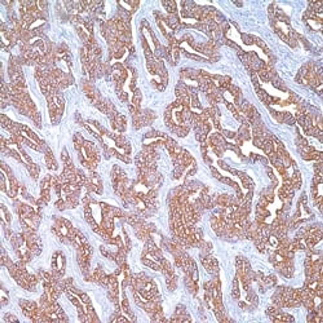 Cytokeratin Cocktail on colon.