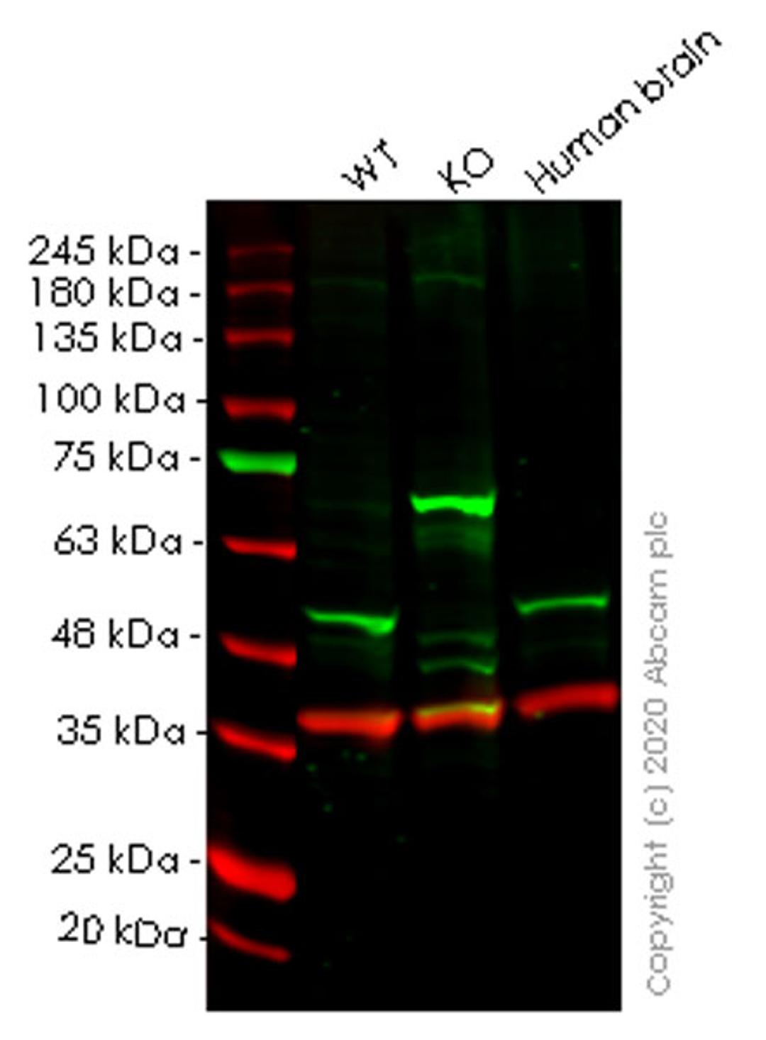 WB - CSNK1E knockout HeLa