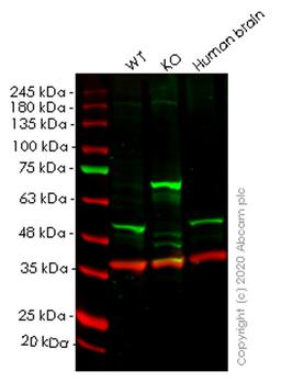 WB - CSNK1E knockout HeLa