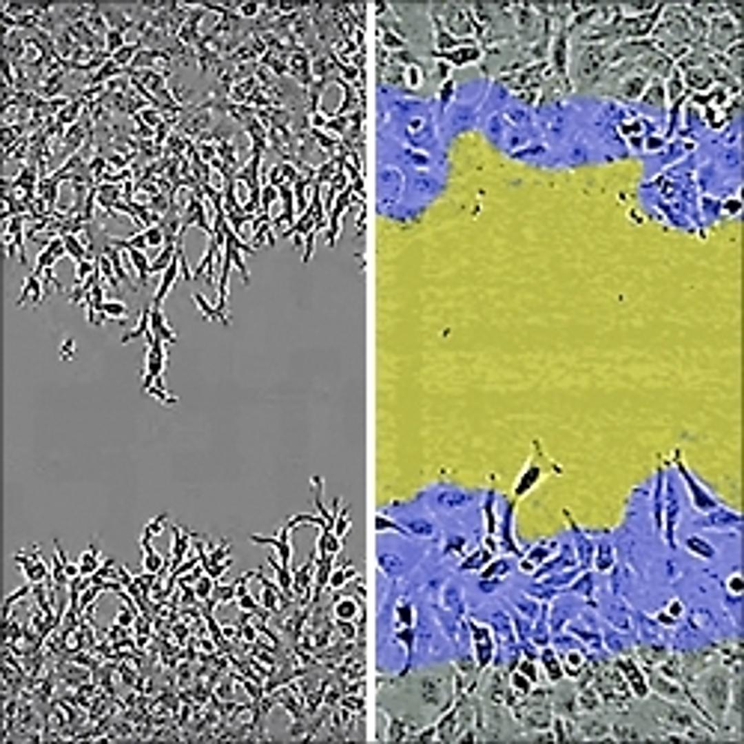 HT-1080 cells invade into the wounded area