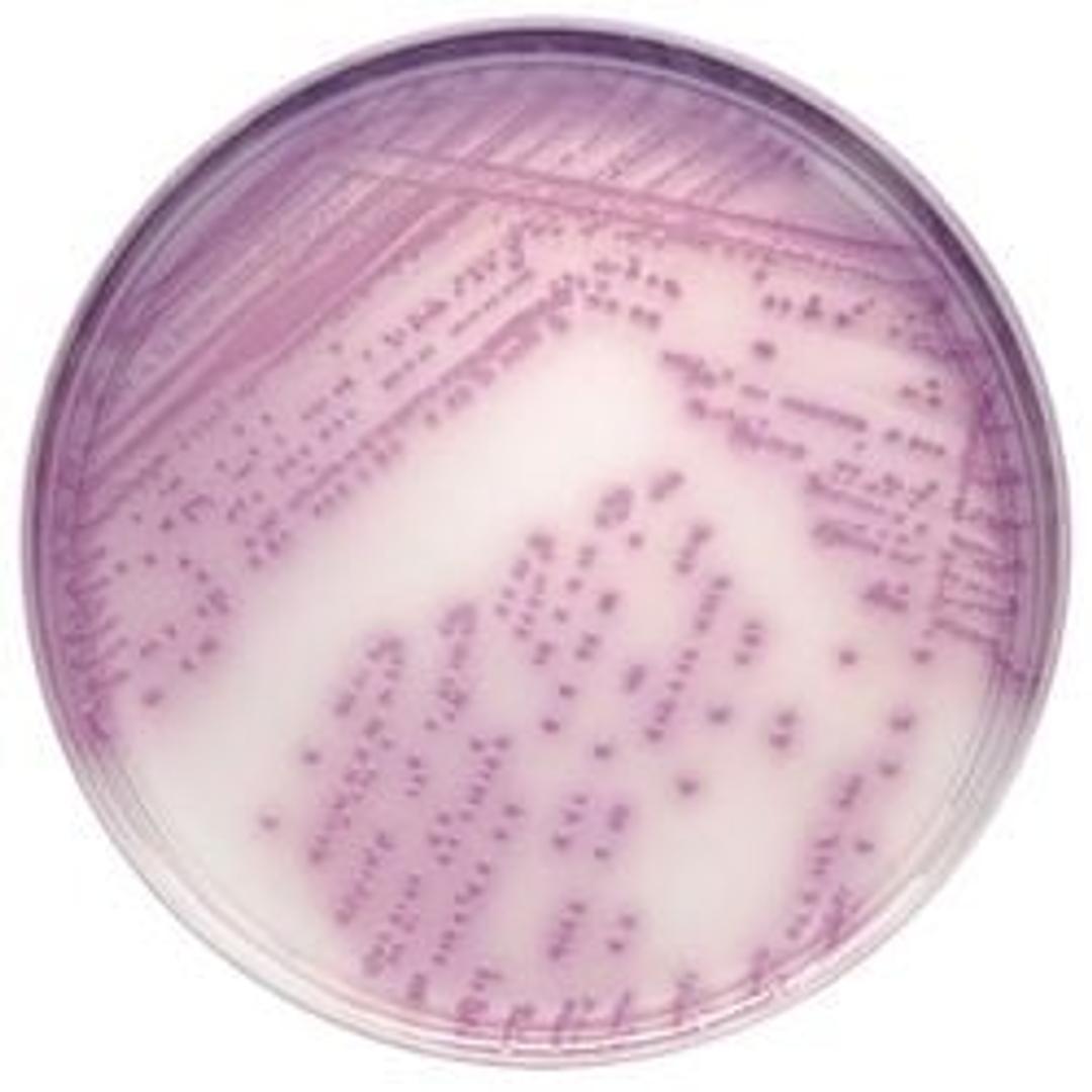 BD BBL™ CHROMagar™ Salmonella Plate