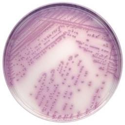 BD BBL™ CHROMagar™ Salmonella Plate