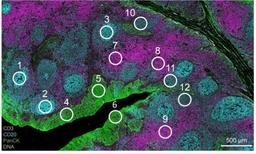 Digital Spatial Profiling (DSP) Technology