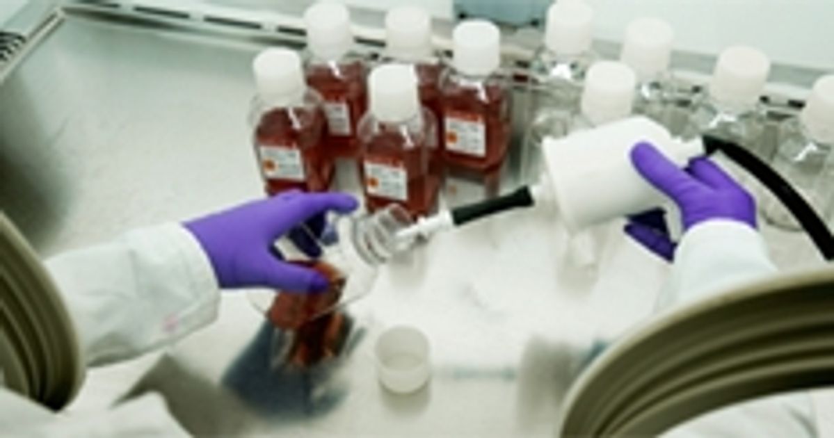 Buy Source BioScience Serology Read Reviews