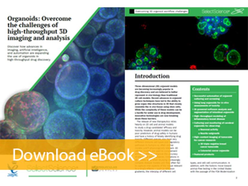 Organoids: Overcome the challenges of high-throughput 3D imaging and analysis eBook preview