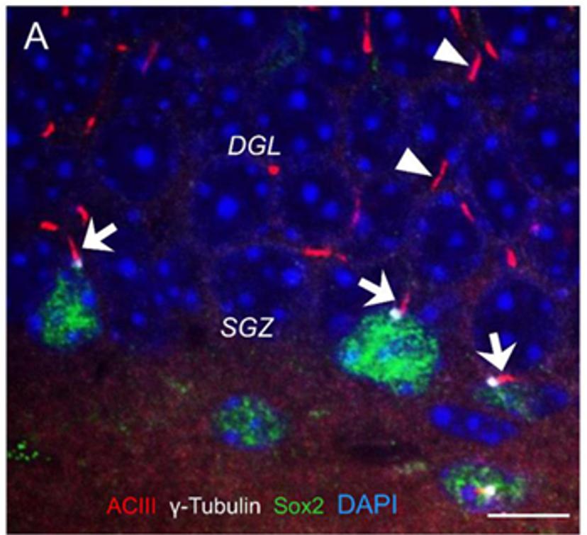 Cilia