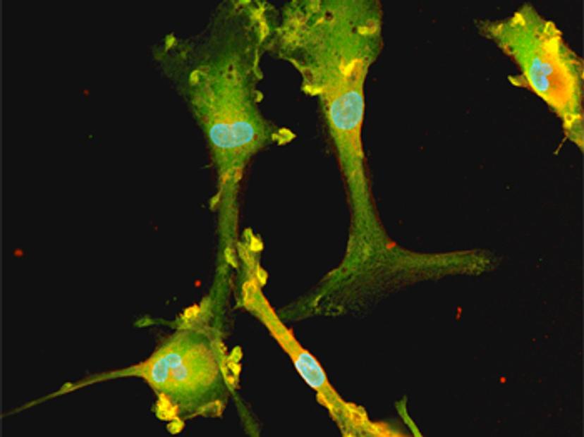 Image of hiPSC-derived microglia