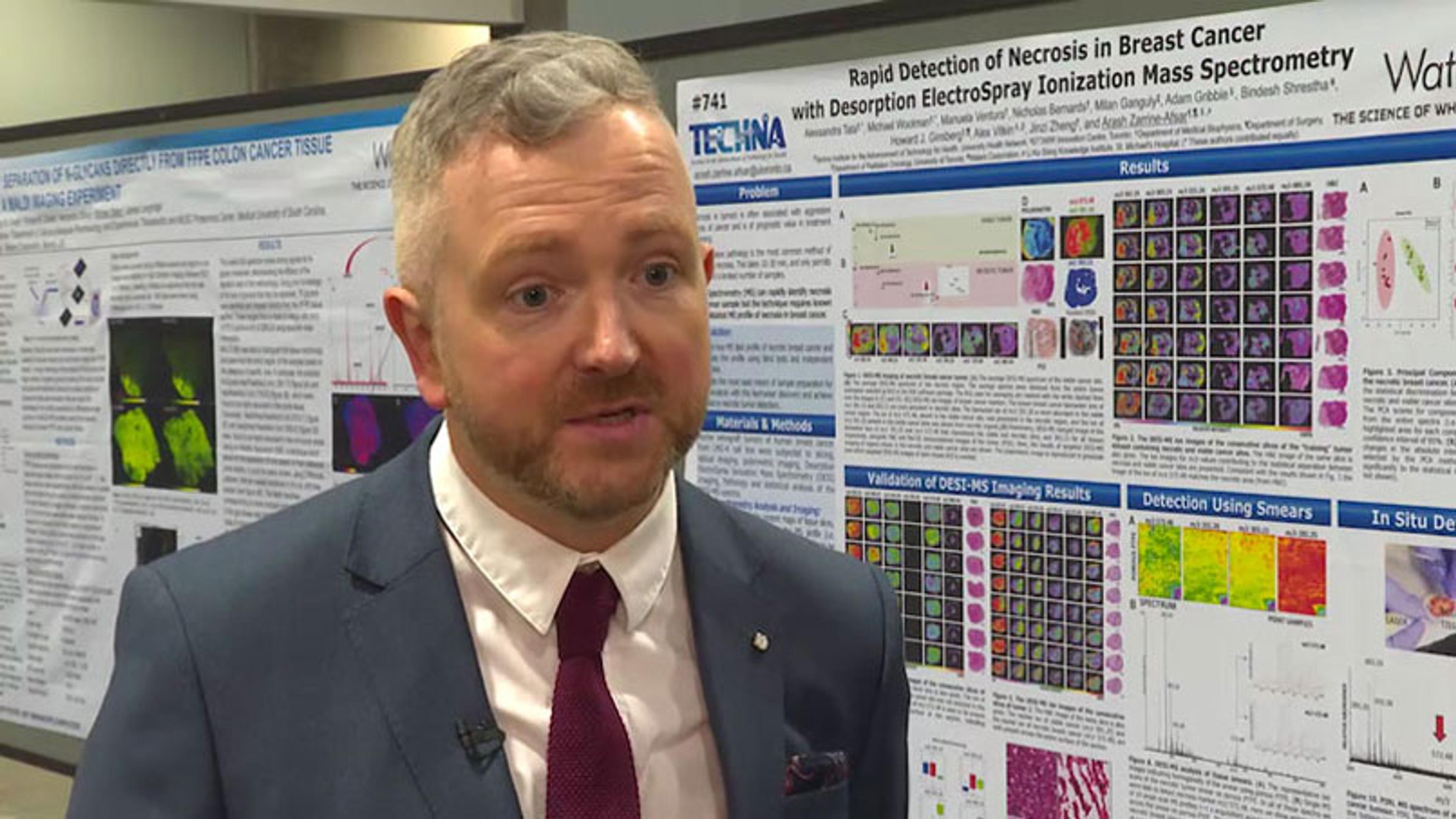 Identifying Necrosis in Breast Cancer Using Electrospray Ionization Mass Spectrometry Identifying Necrosis in Breast Cancer Using Electrospray Ionization Mass Spectrometry