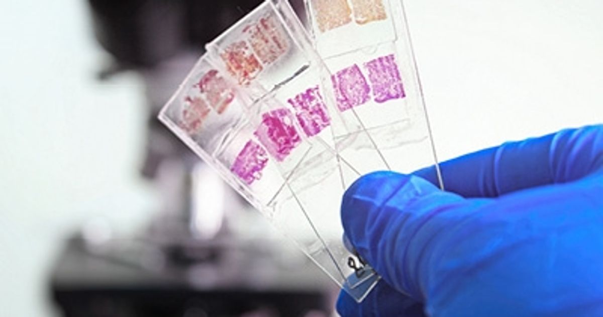 Buy Tissue Samples for Research Read Reviews