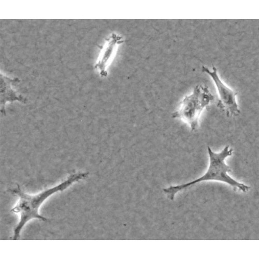 Endothelial cells in a 3D Collagen I gel
