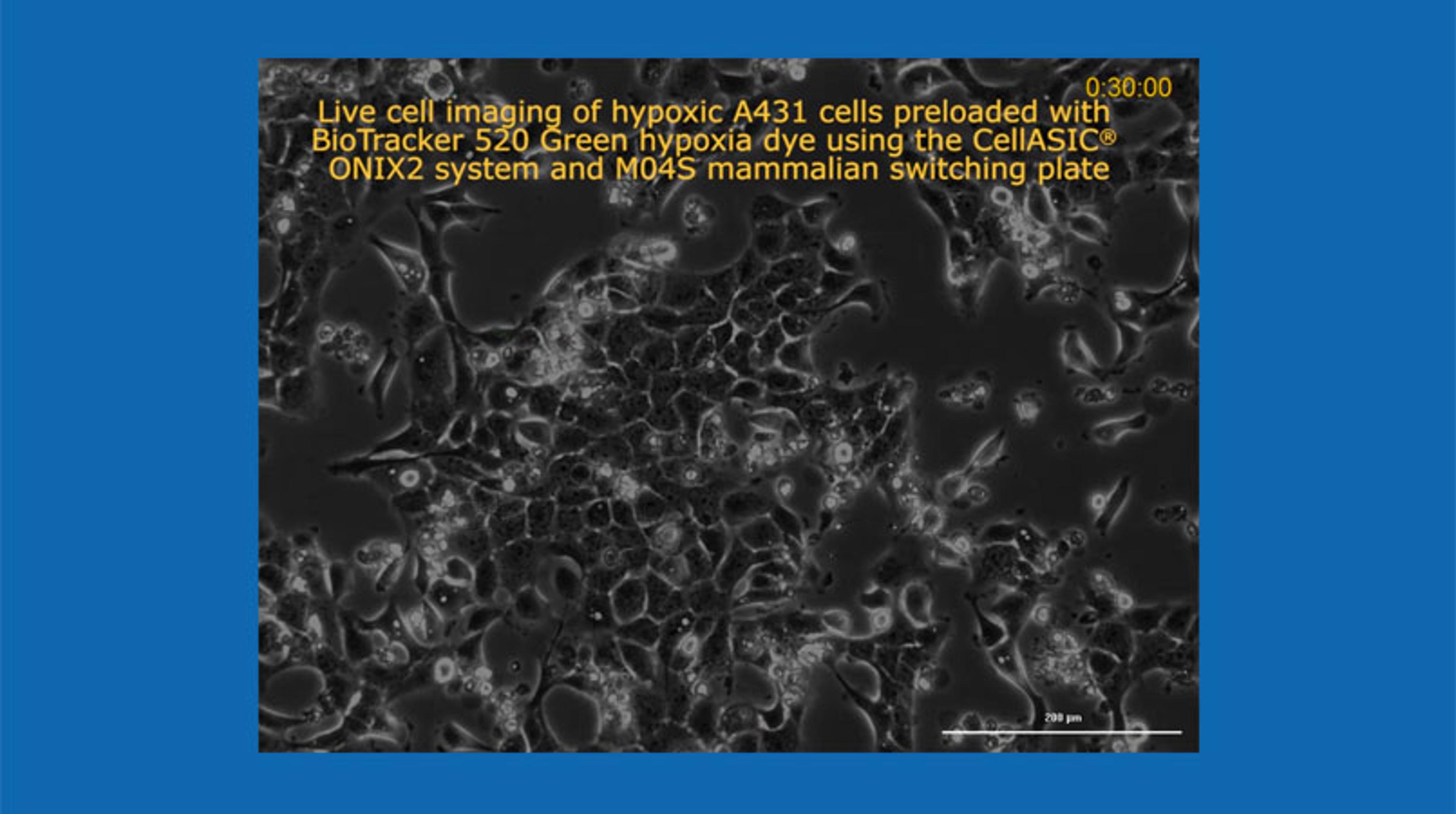 Live Cell Imaging of Hypoxia in Cancer Cells using the CellASIC® ONIX2 Microfluidic System Live Cell Imaging of Hypoxia in Cancer Cells using the CellASIC® ONIX2 Microfluidic System