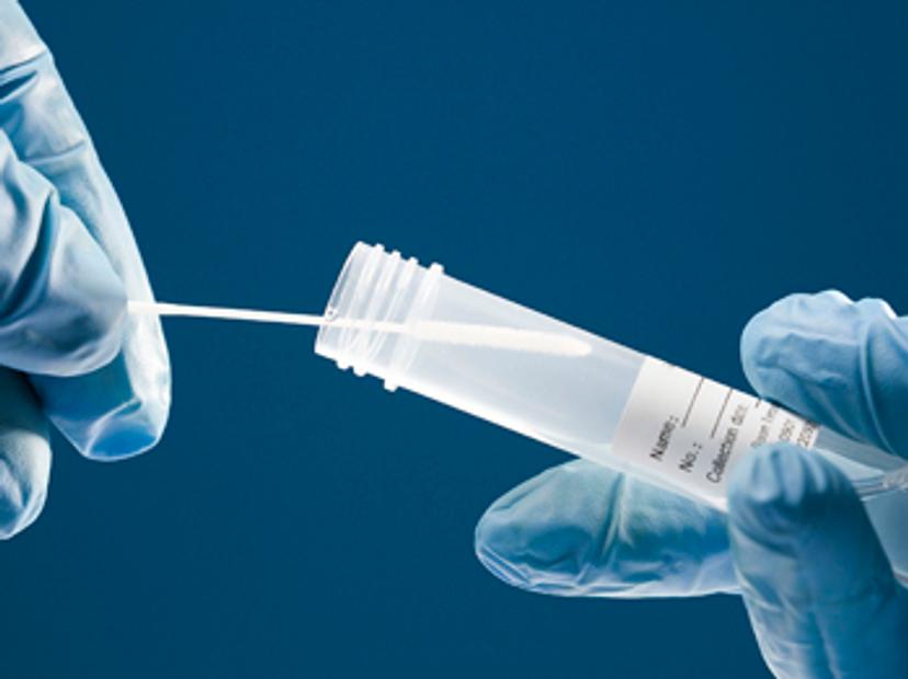 SARS-CoV-2 PCR test