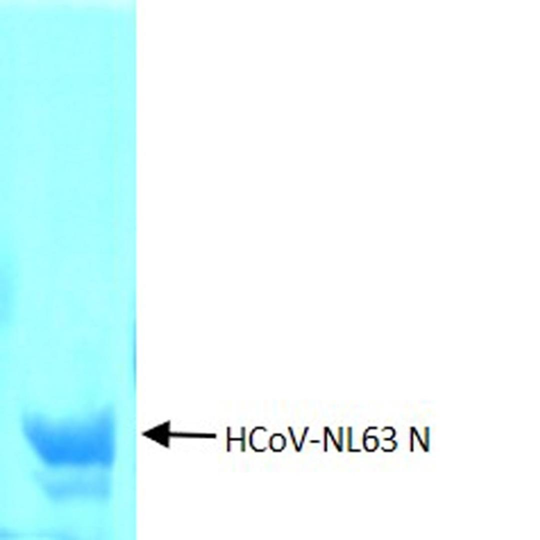 SDS-PAGE of purified recombinant HCoV-NL63 nucleoprotein (N)