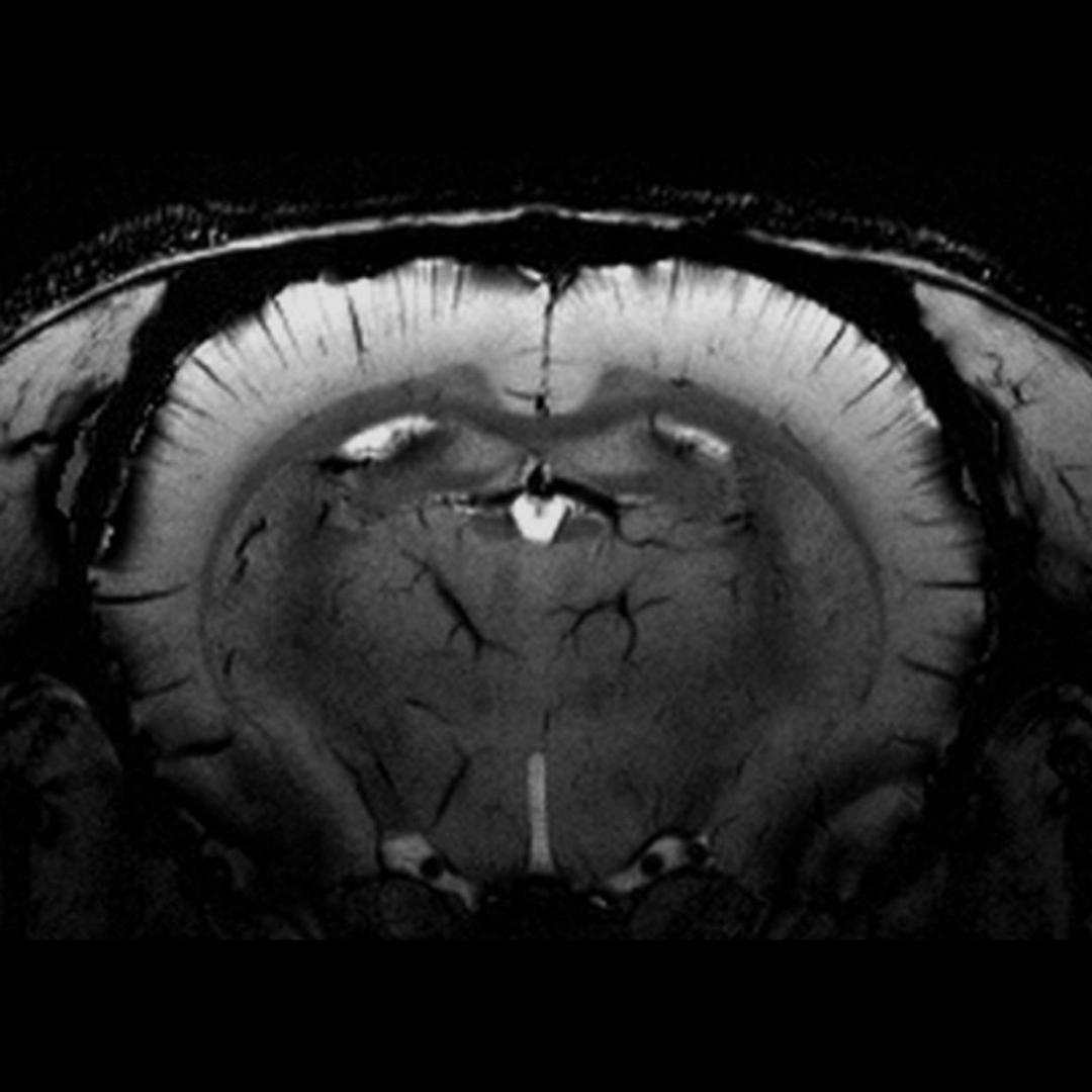 Susceptibility Weighted Imaging of Rat Brain