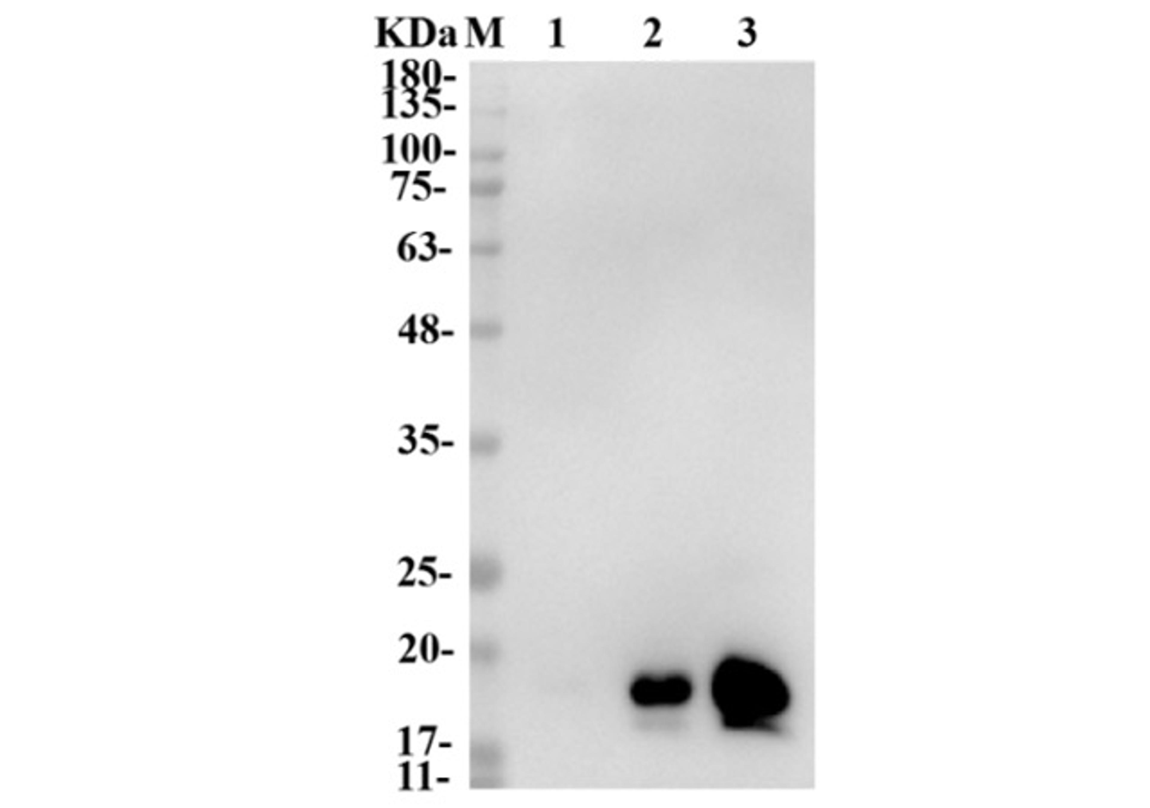 Human Anti-VEGF Recombinant Antibody (clone B20-4)
