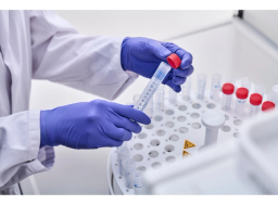 ICprep Series fraction collector